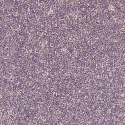 Immunohistochemistry-Paraffin: PAG608 Antibody [NBP2-62599] - Staining of human tonsil shows low expression as expected.