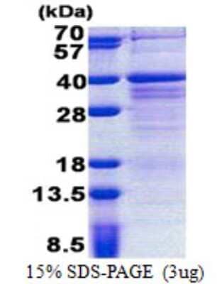 SDS-PAGE Recombinant Human PAG608 His Protein