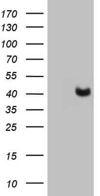Western Blot PAGE1 Antibody (OTI3E7)