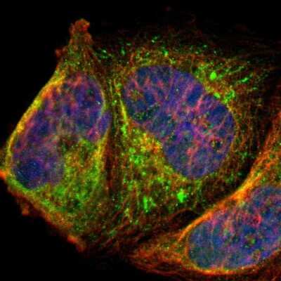 Immunocytochemistry/ Immunofluorescence PAGE1 Antibody