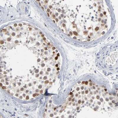 Immunohistochemistry-Paraffin: PAGE1 Antibody [NBP1-85414] - Staining of human testis shows high expression.