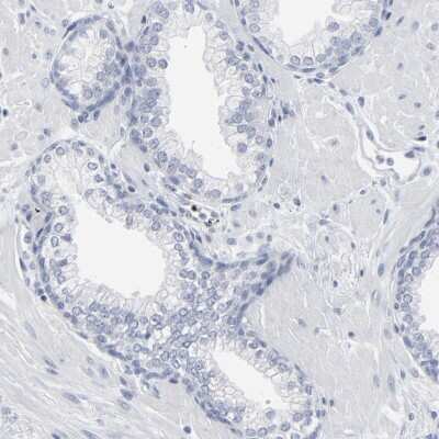 Immunohistochemistry-Paraffin PAGE1 Antibody