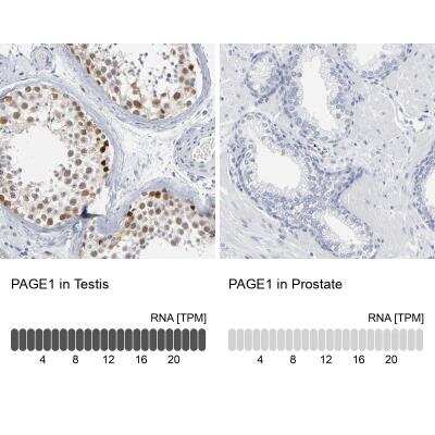 Immunohistochemistry-Paraffin PAGE1 Antibody