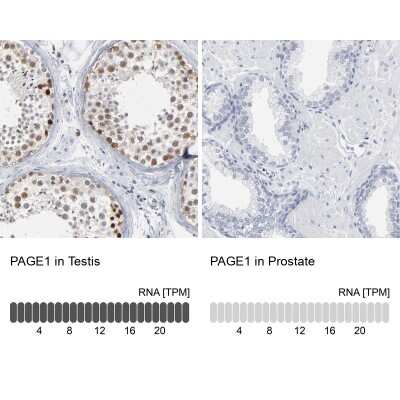 <b>Orthogonal Strategies Validation. </b>Immunohistochemistry-Paraffin: PAGE1 Antibody [NBP1-85414] - Analysis in human testis and prostate tissues. Corresponding PAGE1 RNA-seq data are presented for the same tissues.