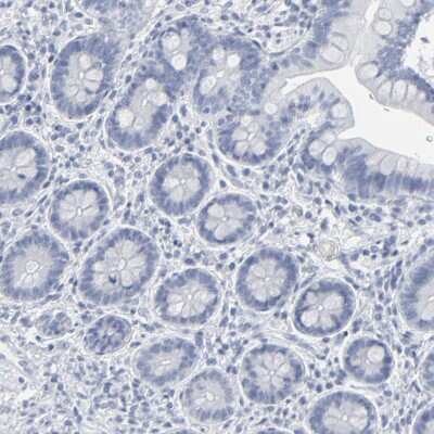 Immunohistochemistry-Paraffin: PAGE1 Antibody [NBP1-85414] - Staining of human gastrointestinal shows no positivity in glandular cells as expected.