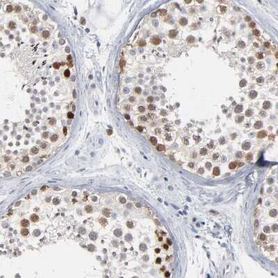Immunohistochemistry-Paraffin: PAGE1 Antibody [NBP1-85414] - Staining of human testis shows moderate nuclear positivity in cells in seminiferous ducts.
