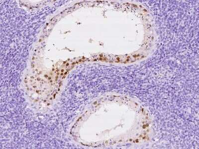 Immunohistochemistry-Paraffin: PAGE1 Antibody [NBP2-97691] - Immunochemical staining of human PAGE1 in human testis with rabbit polyclonal antibody at 1:2000 dilution, formalin-fixed paraffin embedded sections.