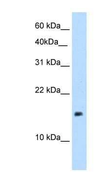 Western Blot: PAGE1 Antibody [NBP1-58313] - 721_B cell lysate, concentration 5.0ug/ml.