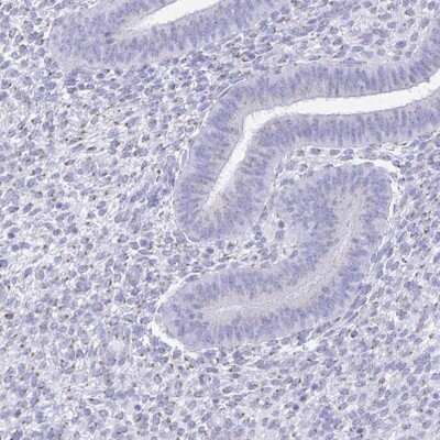 Immunohistochemistry-Paraffin PAGE4 Antibody