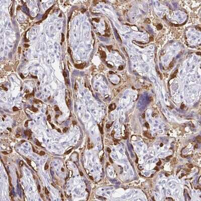 Immunohistochemistry-Paraffin PAGE4 Antibody