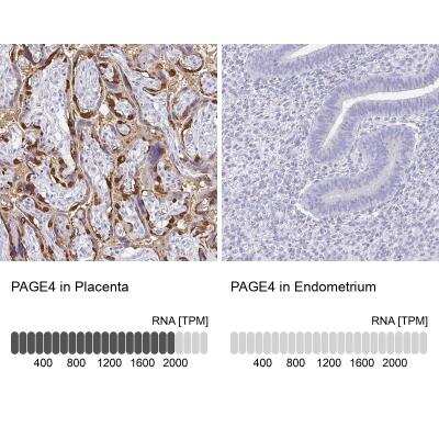 Immunohistochemistry-Paraffin PAGE4 Antibody