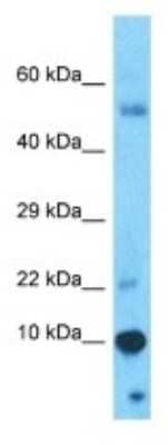 Western Blot: PAGE4 Antibody [NBP3-10548] - Western blot analysis of PAGE4 in Thymus Tumor lysates. Antibody dilution at 1.0ug/ml