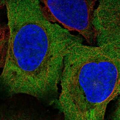 Immunocytochemistry/Immunofluorescence: PAIP1 Antibody [NBP2-56045] - Staining of human cell line U-2 OS shows localization to plasma membrane & cytosol.