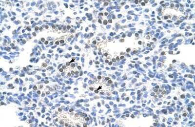 Immunohistochemistry-Paraffin: PAIP1 Antibody [NBP1-57310] - Human Lung Alveolar cells (indicated with arrows), 4-8ug/ml.