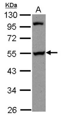 Western Blot: PAIP1 Antibody [NBP2-19679] - Sample (30 ug of whole cell lysate) A: A431 10% SDS PAGE gel, diluted at 1:1000.