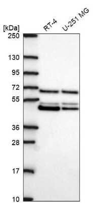 Western Blot: PAIP1 Antibody [NBP2-68963] - Analysis in human cell line RT-4 and human cell line U-251 MG.