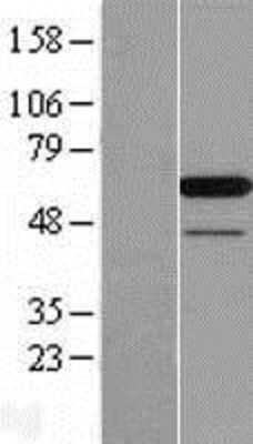 Western Blot: PAIP1 Overexpression Lysate (Adult Normal) [NBL1-14074] Left-Empty vector transfected control cell lysate (HEK293 cell lysate); Right -Over-expression Lysate for PAIP1.