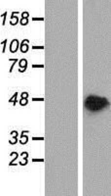 Western Blot: PAIP1 Overexpression Lysate (Adult Normal) [NBP2-10060] Left-Empty vector transfected control cell lysate (HEK293 cell lysate); Right -Over-expression Lysate for PAIP1.