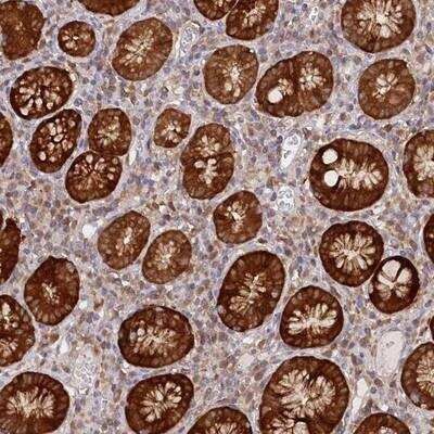 Immunohistochemistry-Paraffin PAIP2 Antibody