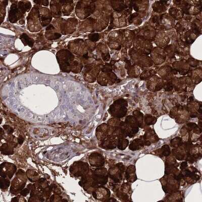 Immunohistochemistry-Paraffin PAIP2B Antibody