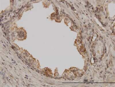 Immunohistochemistry-Paraffin: PAK1 Antibody (1E11) [H00005058-M01] - Analysis of monoclonal antibody to PAK1 on formalin-fixed paraffin-embedded human prostate. Antibody concentration 3 ug/ml.