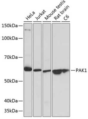 Western Blot: PAK1 Antibody (6R3M5) [NBP3-15811] - Western blot analysis of extracts of various cell lines, using PAK1 antibody (NBP3-15811) at 1:1000 dilution. Secondary antibody: HRP Goat Anti-Rabbit IgG (H+L) at 1:10000 dilution. Lysates/proteins: 25ug per lane. Blocking buffer: 3% nonfat dry milk in TBST. Detection: ECL Basic Kit. Exposure time: 1s.