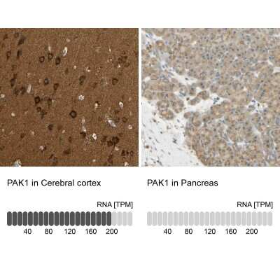 Immunohistochemistry-Paraffin: PAK1 Antibody [NBP1-85802] - Staining in human cerebral cortex and pancreas tissues using anti-PAK1 antibody. Corresponding PAK1 RNA-seq data are presented for the same tissues.