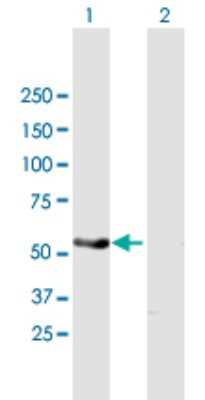 Western Blot: PAK1 Antibody [H00005058-B01P] - Analysis of PAK1 expression in transfected 293T cell line by PAK1 polyclonal antibody.  Lane1:PAK1 transfected lysate(49.17 KDa). Lane2:Non-transfected lysate.