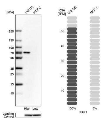 Western Blot: PAK1 Antibody [NBP1-85802] - Analysis in human cell lines U2OS and MCF-7 using Anti-PAK1 antibody. Corresponding PAK1 RNA-seq data are presented for the same cell lines. Loading control: Anti-GAPDH.