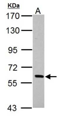 Western Blot: PAK1 Antibody [NBP2-19680] - Sample (30 ug of whole cell lysate) A: BCL-1 7. 5% SDS PAGE gel, diluted at 1:10000.