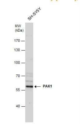 Western Blot: PAK1 Antibody [NBP2-19680] - Whole cell extracts (30 ug) was separated by 7.5% SDS-PAGE, and the membrane was blotted with PAK1 antibody  diluted at 1:1000.