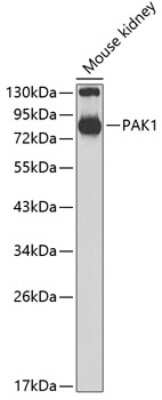 Western Blot: PAK1 Antibody [NBP3-04201] - Analysis of extracts of mouse kidney, using PAK1 antibody at 1:700 dilution. Secondary antibody: HRP Goat Anti-Rabbit IgG (H+L) at 1:10000 dilution. Lysates/proteins: 25ug per lane. Blocking buffer: 3% nonfat dry milk in TBST.