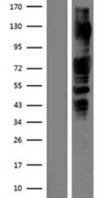 Western Blot PAK1 Overexpression Lysate