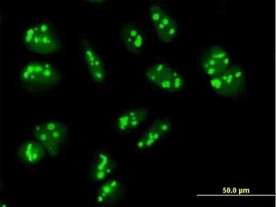 Immunocytochemistry/Immunofluorescence: PAK1 interacting protein 1 Antibody [H00055003-B01P] - Analysis of purified antibody to PAK1IP1 on HeLa cell. (antibody concentration 10 ug/ml)