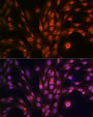 Immunocytochemistry/Immunofluorescence: PAK2 Antibody (2Y7I2) [NBP3-16433] - Immunofluorescence analysis of C6 cells using PAK2 antibody (NBP3-16433) at dilution of 1:100. Blue: DAPI for nuclear staining.