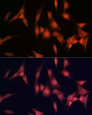 Immunocytochemistry/Immunofluorescence: PAK2 Antibody (2Y7I2) [NBP3-16433] - Immunofluorescence analysis of NIH/3T3 cells using PAK2 antibody (NBP3-16433) at dilution of 1:100. Blue: DAPI for nuclear staining.