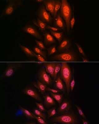 Immunocytochemistry/Immunofluorescence: PAK2 Antibody (2Y7I2) [NBP3-16433] - Immunofluorescence analysis of U2OS cells using PAK2 antibody (NBP3-16433) at dilution of 1:100. Blue: DAPI for nuclear staining.