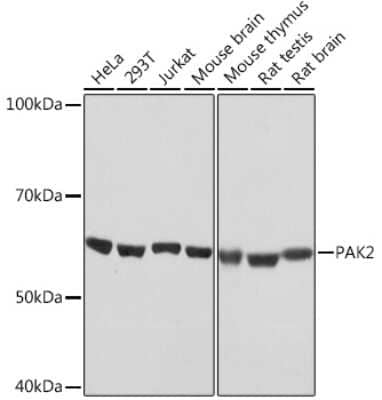 Western Blot PAK2 Antibody (2Y7I2)