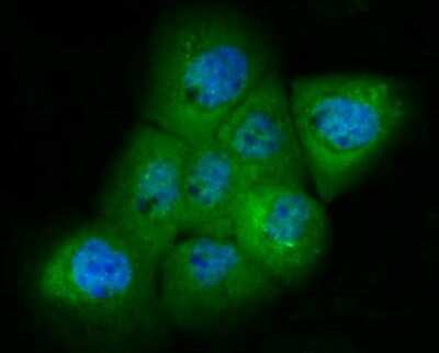 Immunocytochemistry/Immunofluorescence: PAK2 Antibody (JB41-84) [NBP2-75607] - Staining PAK2 in A431 cells (green). The nuclear counter stain is DAPI (blue). Cells were fixed in paraformaldehyde, permeabilised with 0.25% Triton X100/PBS.