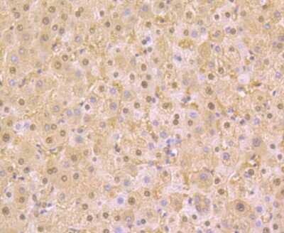 Immunohistochemistry-Paraffin: PAK2 Antibody (JB41-84) [NBP2-75607] - Analysis of paraffin-embedded human liver tissue using anti-PAK2 antibody. Counter stained with hematoxylin.