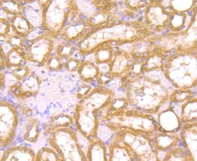 Immunohistochemistry-Paraffin: PAK2 Antibody (JB41-84) [NBP2-75607] - Analysis of paraffin-embedded rat kidney tissue using anti-PAK2 antibody. Counter stained with hematoxylin.