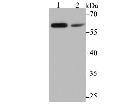 Western Blot: PAK2 Antibody (JB41-84) [NBP2-75607] - Analysis of PAK2 on mouse thymus tissue (1) and MCF-7 cell (2) lysate using anti-PAK2 antibody at 1/500 dilution.