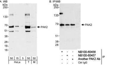 Western Blot: PAK2 Antibody [NB100-60456] - Detection of Human and Mouse PAK2 on HeLa whole cell lysate using NB100-60456. PAK2 was also immunoprecipitated by rabbit anti-PAK2 antibodies NB100-60457 and Another PAK2.