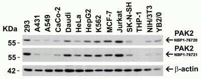 <b>Independent Antibodies Validation. </b>Western Blot: PAK2 Antibody [NBP1-76721] - Validation (IAV) via Protein Expression Profile in Cell Lines.Loading: 15 ug of lysates per lane. Antibodies: PAK2 NBP1-76720 (1 ug/mL), PAK2 NBP1-76721 (1 ug/mL) and beta-actin (1 ug/mL), 1h incubation at RT in 5% NFDM/TBST. Secondary: Goat anti-rabbit IgG HRP conjugate at 1:10000 dilution.