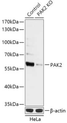 Western Blot: PAK2 Antibody [NBP3-03354] - Analysis of extracts from normal (control) and PAK2 knockout (KO) HeLa cells, using PAK2 antibody at 1:1000 dilution. Secondary antibody: HRP Goat Anti-Rabbit IgG (H+L) at 1:10000 dilution. Lysates/proteins: 25ug per lane. Blocking buffer: 3% nonfat dry milk  in TBST.