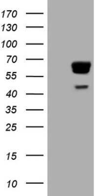 Western Blot: PAK4 Antibody (OTI1C7) - Azide and BSA Free [NBP2-73231] - Analysis of HEK293T cells were transfected with the pCMV6-ENTRY control (Left lane) or pCMV6-ENTRY PAK4.