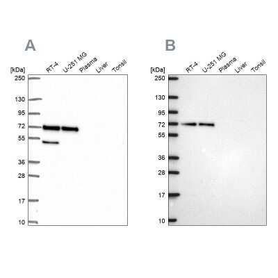 <b>Independent Antibodies Validation. </b>Western Blot: PAK4 Antibody [NBP2-56634] - Analysis using Anti-PAK4 antibody NBP2-56634 (A) shows similar pattern to independent antibody NBP2-58833 (B).