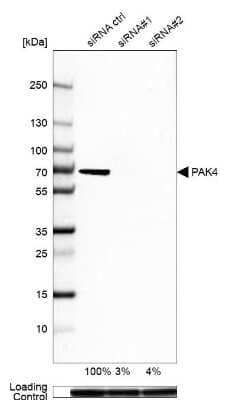 Western Blot: PAK4 Antibody [NBP2-58833] - Analysis in A-549 cells transfected with control siRNA, target specific siRNA probe #1 and #2, using Anti-PAK4 antibody. Remaining relative intensity is presented. Loading control: Anti-GAPDH.