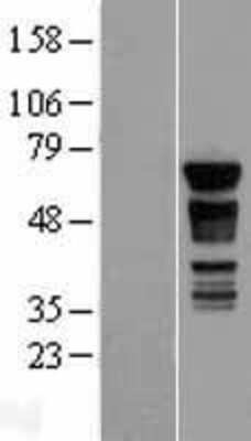 Western Blot: PAK4 Overexpression Lysate (Adult Normal) [NBP2-08746] Left-Empty vector transfected control cell lysate (HEK293 cell lysate); Right -Over-expression Lysate for PAK4.