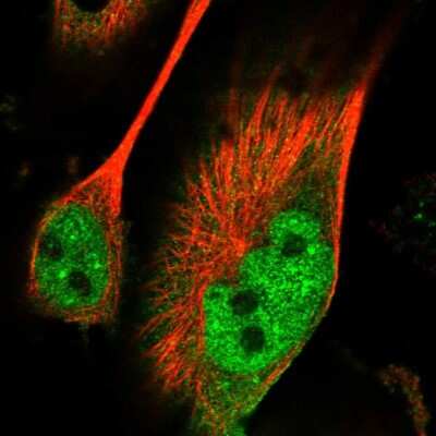 Immunocytochemistry/ Immunofluorescence PAK7 Antibody